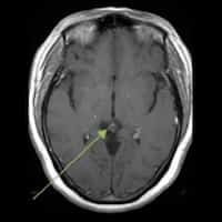 FISIOLOGÍA Y FUNCIONES DE LA GLÁNDULA PINEAL