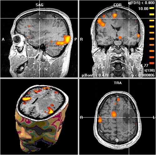 FELITIA MRI